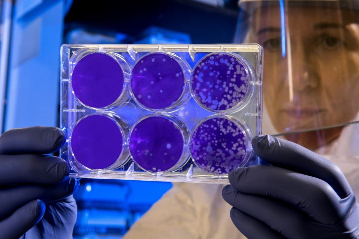 Scientist's hands holding petri dishes with viruses in them